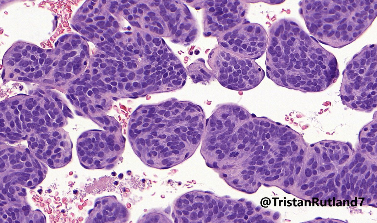 Tristan Rutland MBBS FRCPA IFCAP tweet media