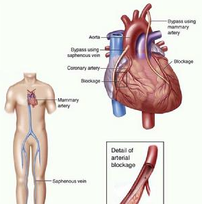 ctdd_stm's tweet photo. #CTDD [Study Protocol] Relationship between apelin and new-onset atrial fibrillation after coronary artery bypass grafting: a prospective cohort study and retrospective case-control clinical trial
#heartdisease #atherosclerosis #atrialfibrillation #apelin

https://t.co/hnvg3qk6X1 https://t.co/mIlfSPENNS