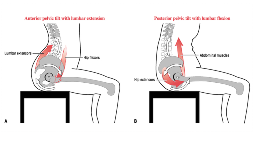 drstretchsg's tweet photo. The "real" reason you have lower back pain, from sitting too long. Let @drstretchsg help you with your aches and pains, and posture correction too ! We treat problems like this and more... When it comes to pain, seek a professional. From the number one stretch shop in Singapore ! https://t.co/XRII9szy8x