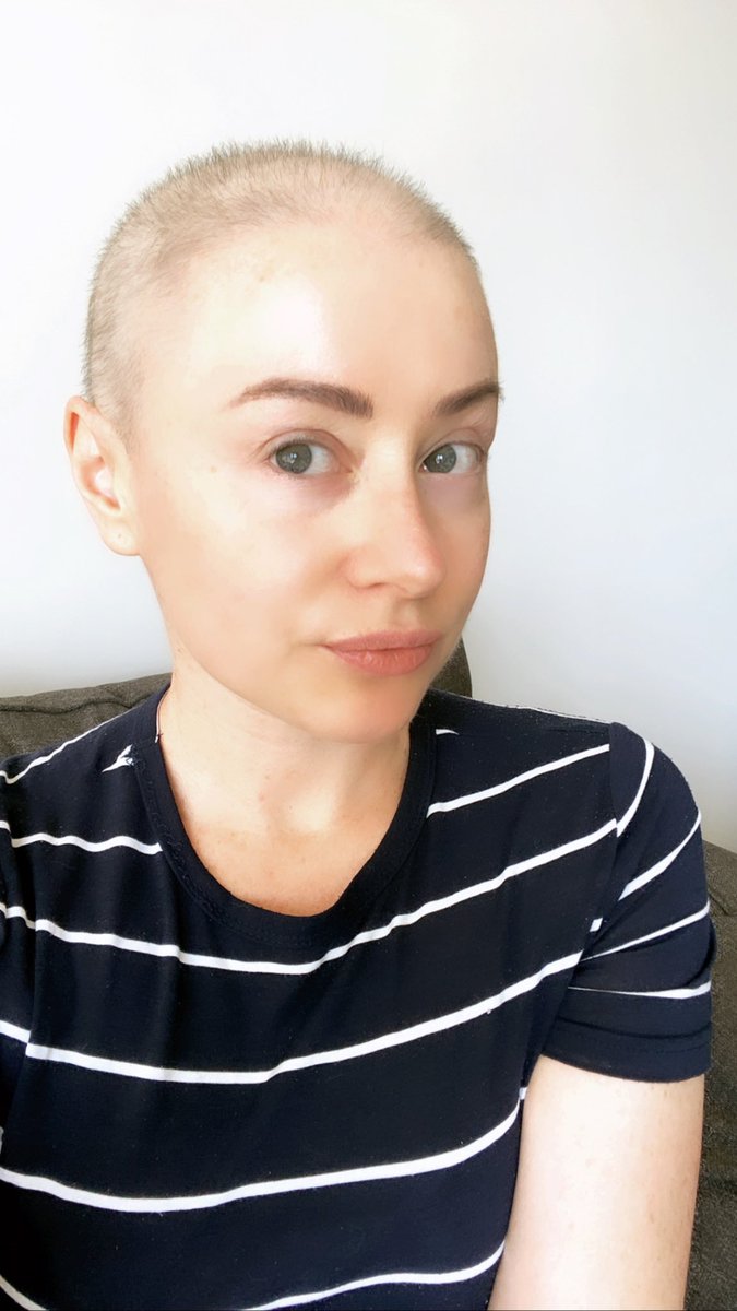 NatsWoodward's tweet photo. Post-chemo hair regrowth... over here looking like I’m about to join the Royal Marines. #giNat #tennisballhead #itsastronglook https://t.co/Hu5dvuKAZp