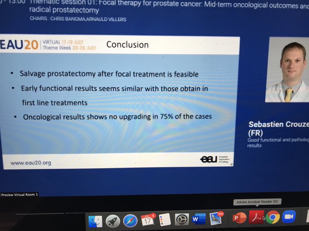 Dr Crouzet presents salvage RALP after focal therapy. Similar functional outcomes to doing primary RALP.
#eau20 #eau2020
