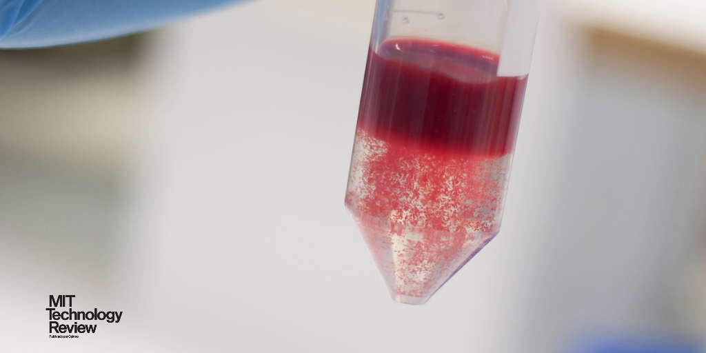 techreview_es's tweet photo. Finalmente, el #grupo sanguíneo tipo A no parece tener más #probabilidades de contagiarse por #coronavirus y sufrir casos más graves
#covid_19 #estudios #investigación #grupos #sangre #tipoA #efectos #impacto #riesgo #estadísticas
https://t.co/ob2s3A5B3M https://t.co/t5uBgzGvvW