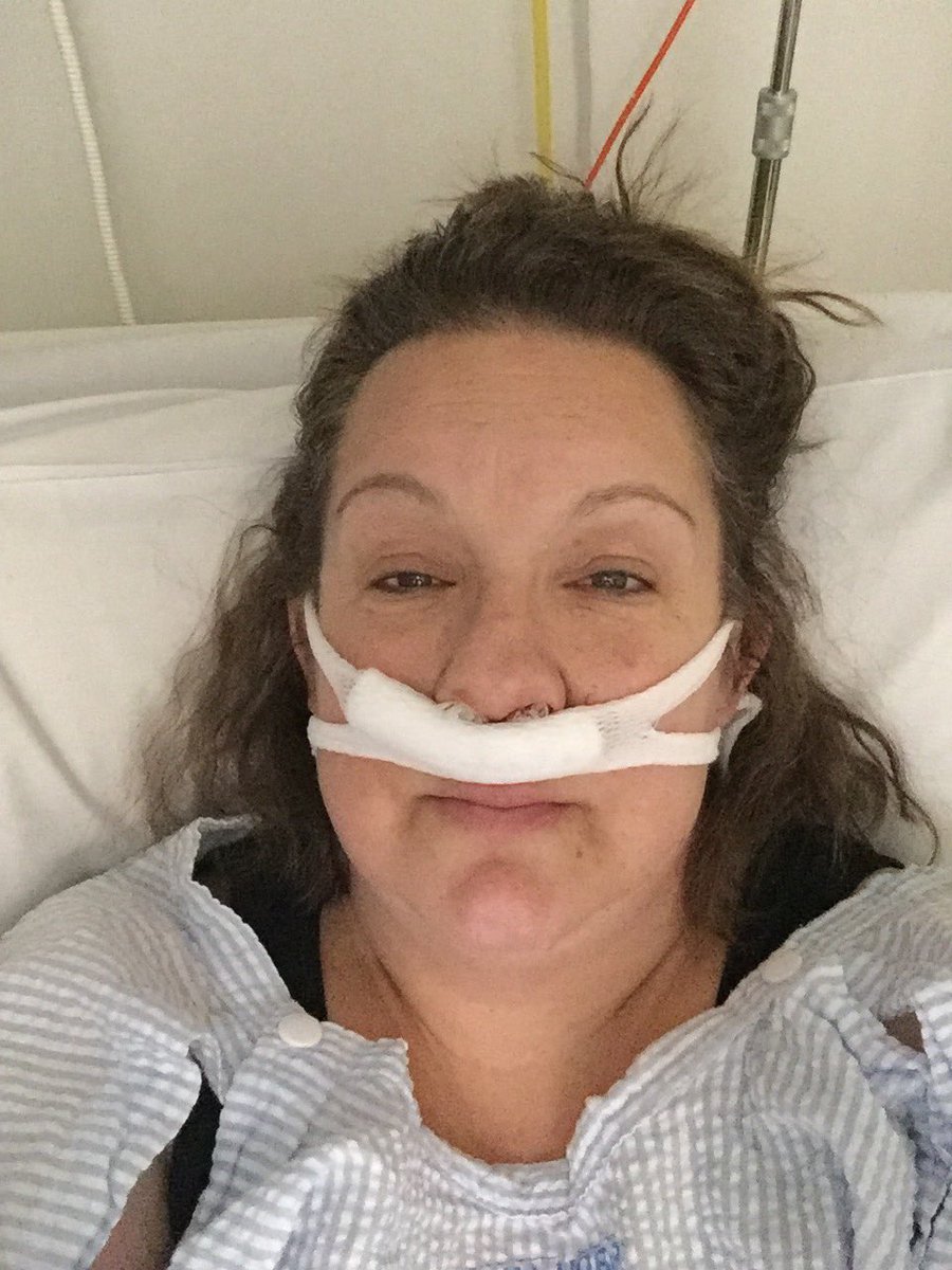 mccaw21's tweet photo. When the Endone kicks in (I’ll regret posting this tomorrow for sure) #SinusSurgery #Endone #ScarySelfie https://t.co/Jf6sCwwe2e