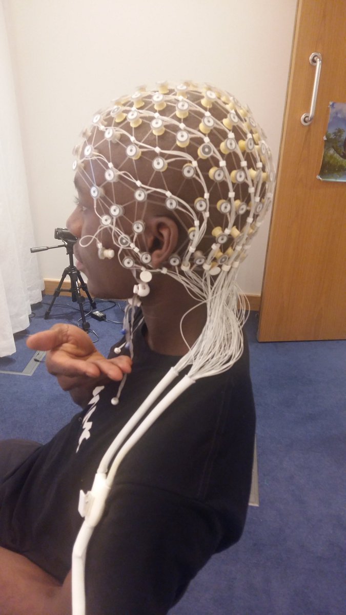 Here is a picture of one type of EEG net which I use in my research. This net has 128 electrodes which is quite a lot of sensors, so would be considered as 'high-density' EEG.