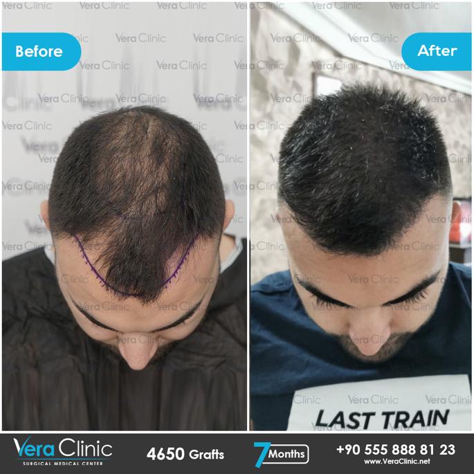 Vera Clinic on Twitter: Vera Clinic on Twitter: