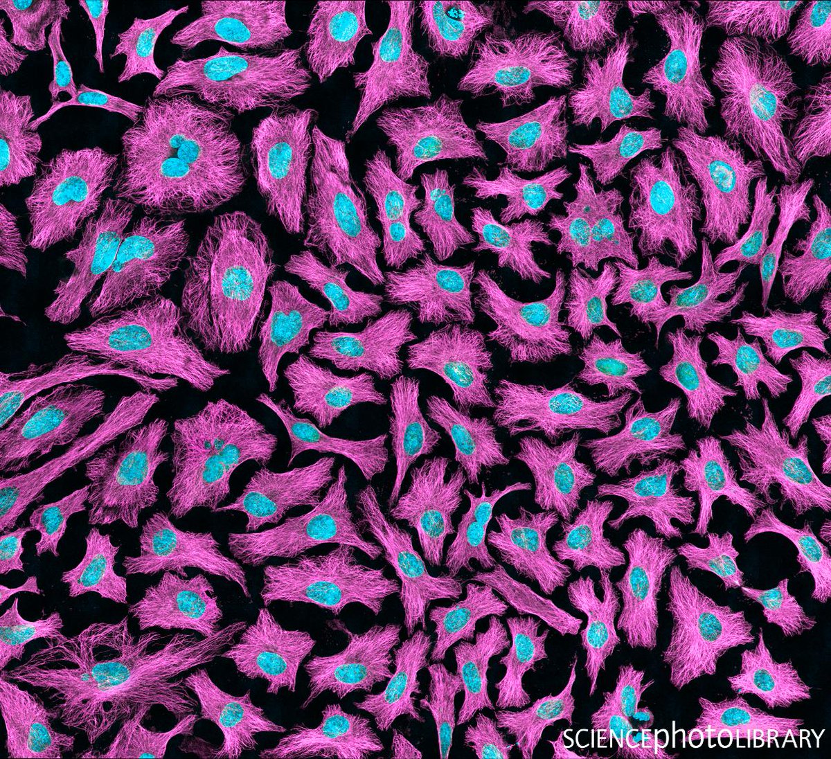 sciencephoto's tweet photo. Widely used in biological and medical research, these HeLa cells look amazing in this multi-photon fluorescence light micrograph.

Credit: Thomas Deerinck, Ncmir /SPL
https://t.co/51xODe3sqQ

 #science #lightmicrograph #hela #helacells #biology #culture #nucleus #oncology https://t.co/cRLosXPuGE