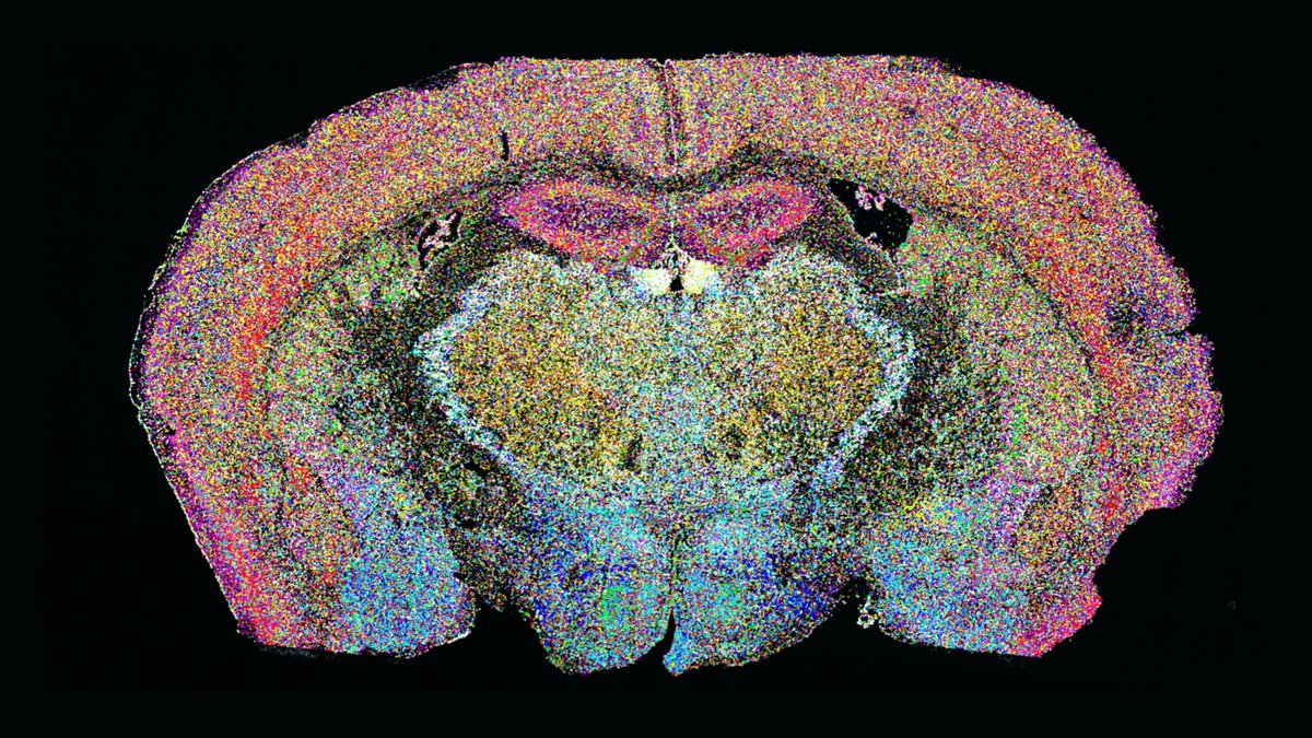 Isn't it beautiful?
With our CARTANA In Situ Sequencing Kit (ISS Kit) you can decode hundreds of genes and spatially map them on tissue at single-cell resolution. This way, you can generate those beautiful bio maps.
Find out more: cartana.se/how-it-works/
#spatial #sequencing #kit