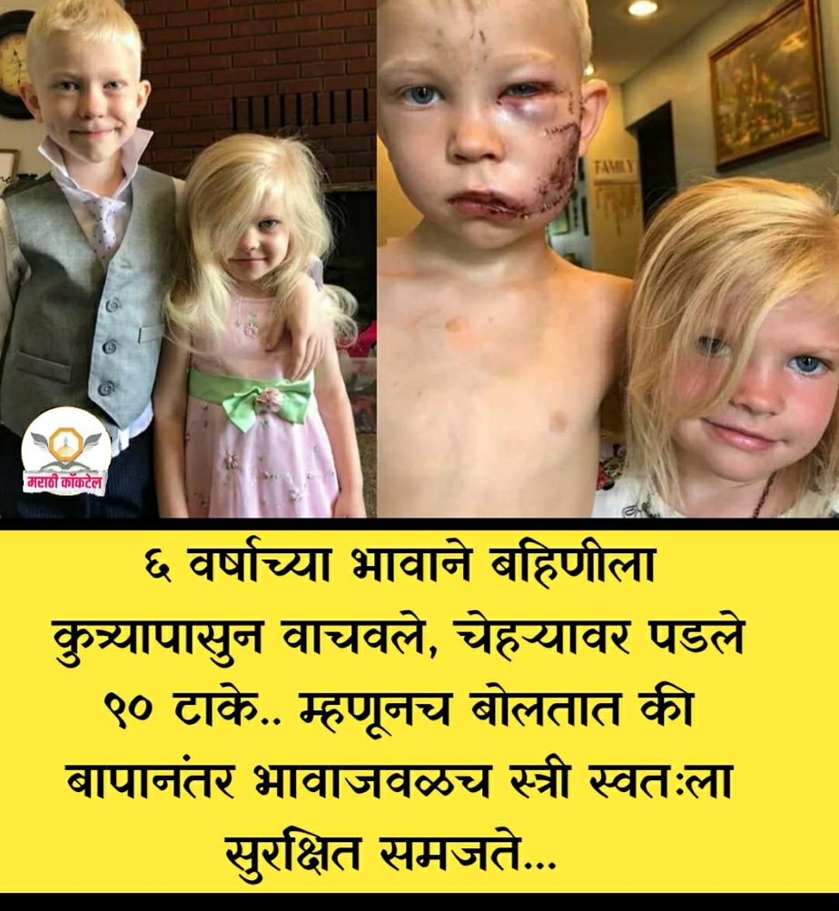 marathicocktail's tweet photo. ६ वर्षाच्या भावाने बहिणीला कुत्र्यापासुन वाचवले, चेहर्‍यावर पडले ९० टाके, म्हणूनच बोलतात की बापानंतर भावाजवळच स्त्री स्वतःला सुरक्षित समजते...
#marathi #marathistatus #मराठी #म #प्रेरणादायक https://t.co/RHEEpUL86z