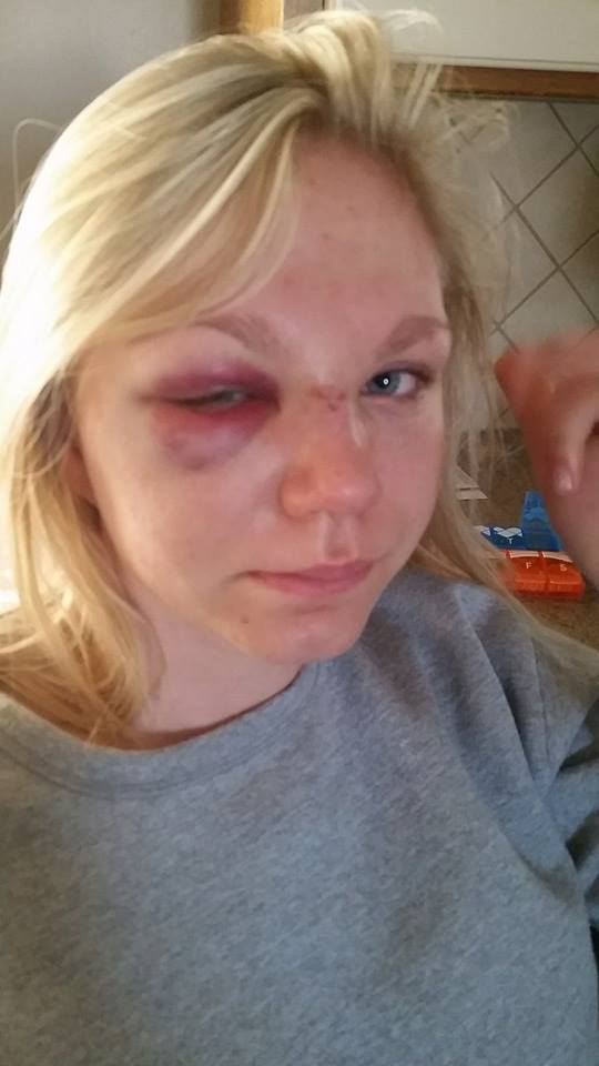 When "catch it with your face" goes wrong...