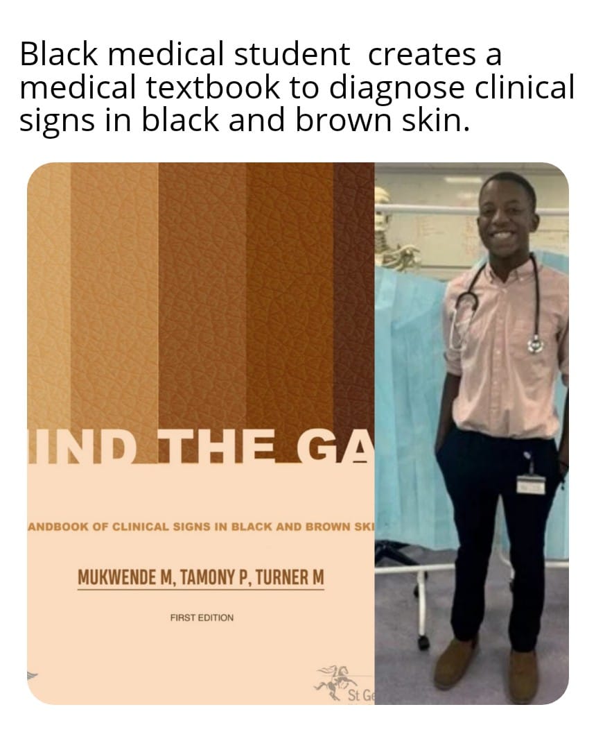 blmwolves's tweet photo. Good Afternoon ✊🏿✊🏾✊🏽✊🏼✊🏻✊
This #FeelGoodFriday we celebrate achievement.
Malone Mukwende a 2nd year student at St. George’s University London who wrote Mind the Gap, as guidance for healthcare professionals, to show how medical conditions manifest on black/brown skin. https://t.co/60ZoUCwGbH