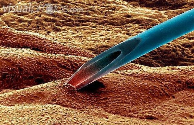 Жиргээчид минь шаардлагагүй тарилгаас зайлсхийгээрэй. Биед хийж буй процедур бүр эрсдэл дагуулж байдгийг санаарай. Ялангуяа витамин, дусал хийлгэхийн оронд эрүүл агаарт гэр бүлтэйгээ амттай шөл хийж уувал мянган лан шүү.