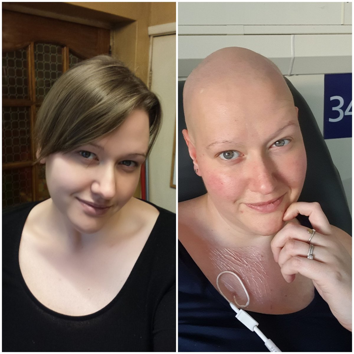 Hi all it Jon its just been over a month since we lost liz , im still miss her like mad and never stop thinking of her 💔