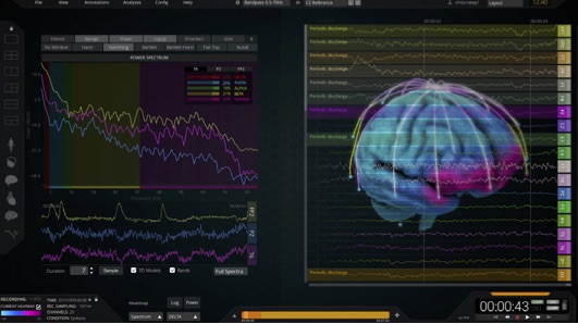TheBrainForum's tweet photo. We are giving free access to @NeuroPro_CH's software NeuroVIS to all attendees of this year's FENS conference. It enables researchers to visualize and explore EEG data accurately in a new way. If you want to take advantage of the offer, get in touch with 📧info@neuropro.ch! https://t.co/mVxq5cyCol