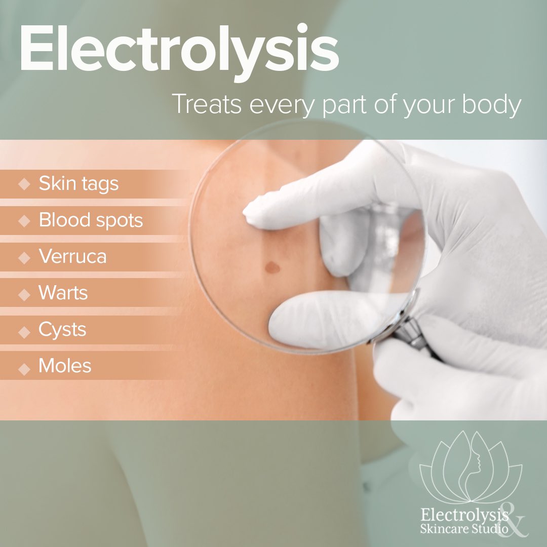 ElectrolysisUK's tweet photo. Electrolysis is well know for hair removal, but it’s capable of so much more.. #skintags #bloodspots #warts https://t.co/JfOwqET5Na https://t.co/w6VCDKorVe