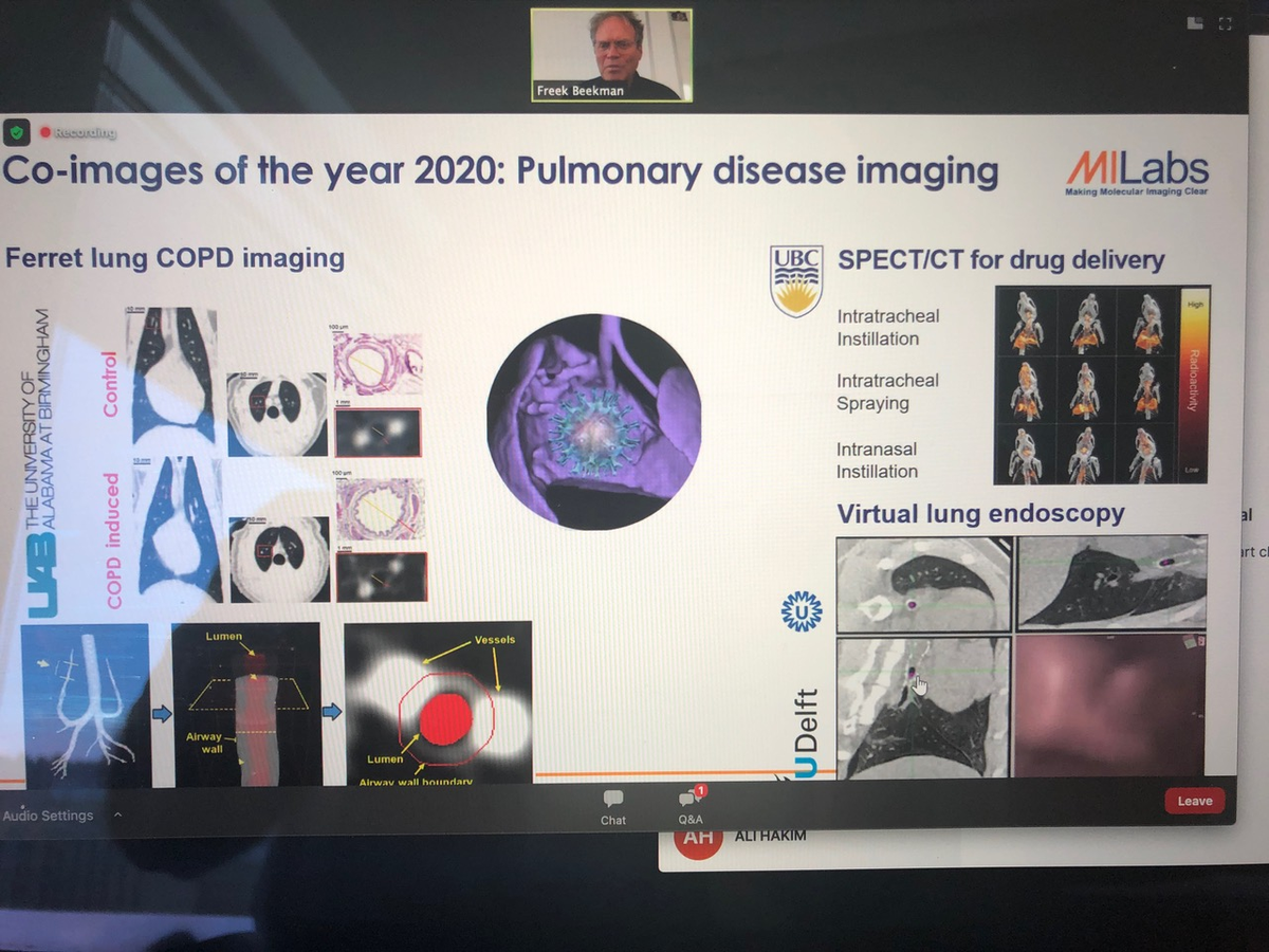Images of the Year in Pulmonary Disease: Ferret Lung COPD imaging
#COPD #ferretlung #images