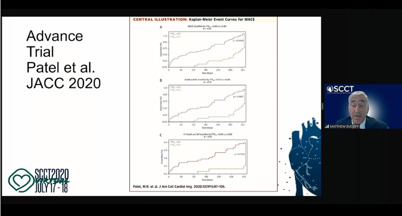 DAICeditor's tweet photo. A review of some of the top new cardiac CT trials by Matt Budoff, M.D., at #SCCT2020 today. Overview of the PARADIGM, EVAPORATE, ADVANCE, FORECAST, PRECISE, CTP-PRO, and WARRIOR trials.
https://t.co/UnSh9rtoj0
#SCCT2020 #CCTAfirst #Radiology #CVimaging #CT #cardiotwitter https://t.co/rfFL7LQSO5