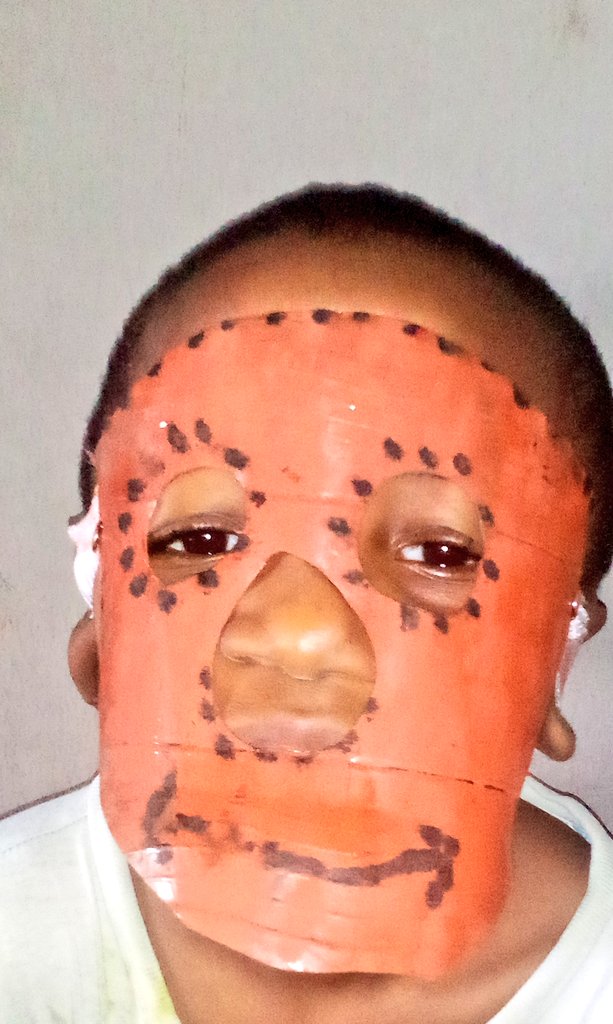 toyinoshaniwa1's tweet photo. Plastic as non-degradable&amp; improper disposal causes #blockeddrainages #pollution #aquatichealth hazard and also to human @toyinoshaniwa1  is collecting  plastic bottle wastes &amp; converts to children party masks @realwecyclers @CoalitionWaste @NatureCaresRC @PlasticBank https://t.co/8sZr5jhgAb