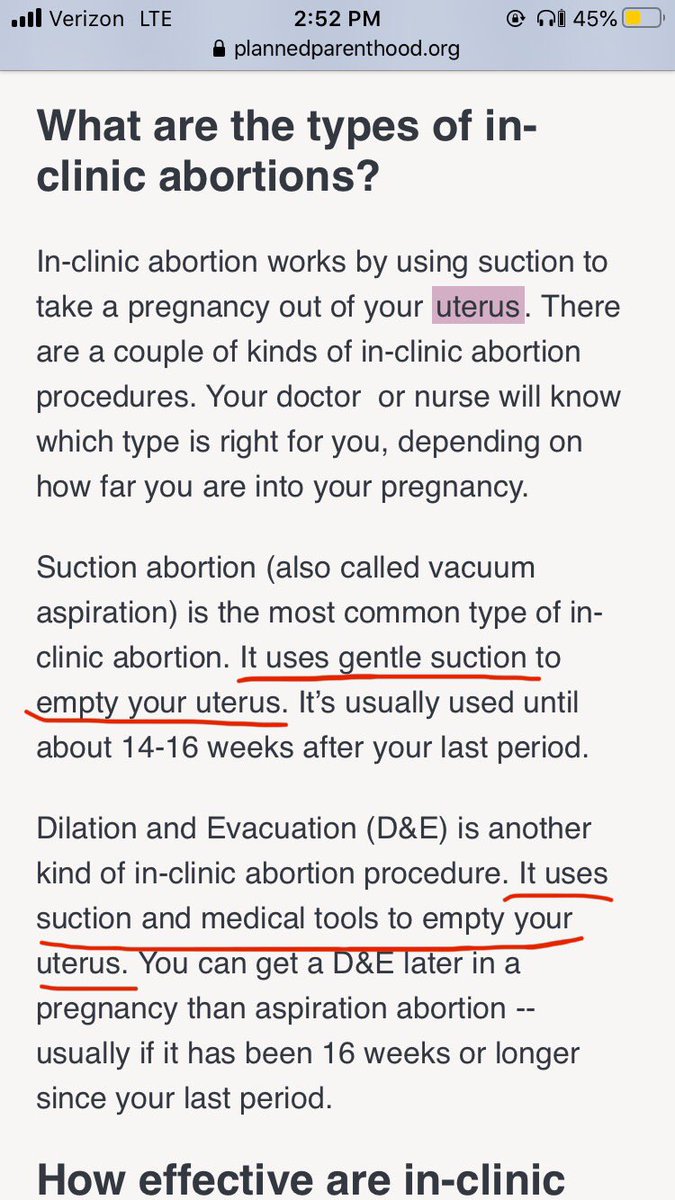 sammyjean29's tweet photo. An ad for #PlannedParenthood popped up today, looked at their website. They’re pretty vague about procedures, saying they use “gentle suction and medical tools” but provide no pictures or videos to actually show women what is happening. If it’s okay, why be so general about it? https://t.co/YyDe0S0sh0