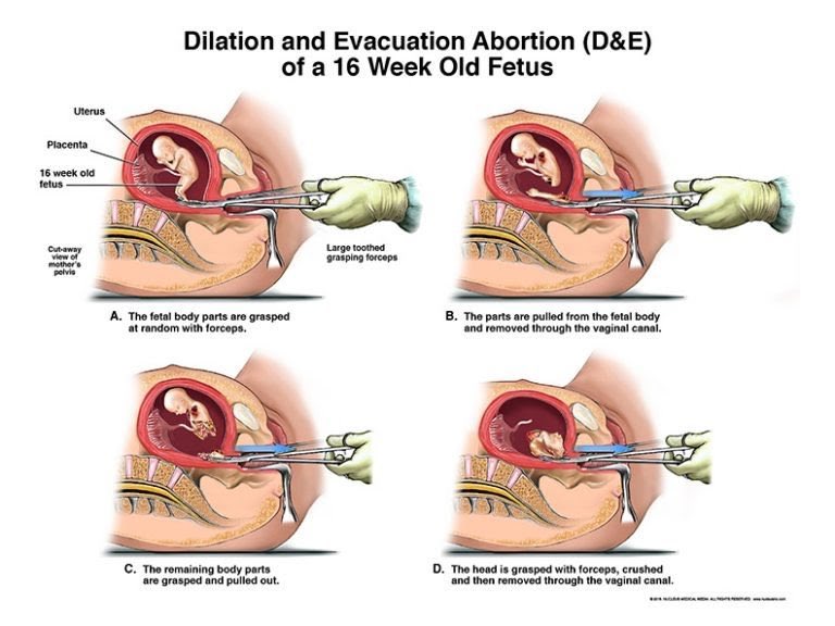 sammyjean29's tweet photo. An ad for #PlannedParenthood popped up today, looked at their website. They’re pretty vague about procedures, saying they use “gentle suction and medical tools” but provide no pictures or videos to actually show women what is happening. If it’s okay, why be so general about it? https://t.co/YyDe0S0sh0