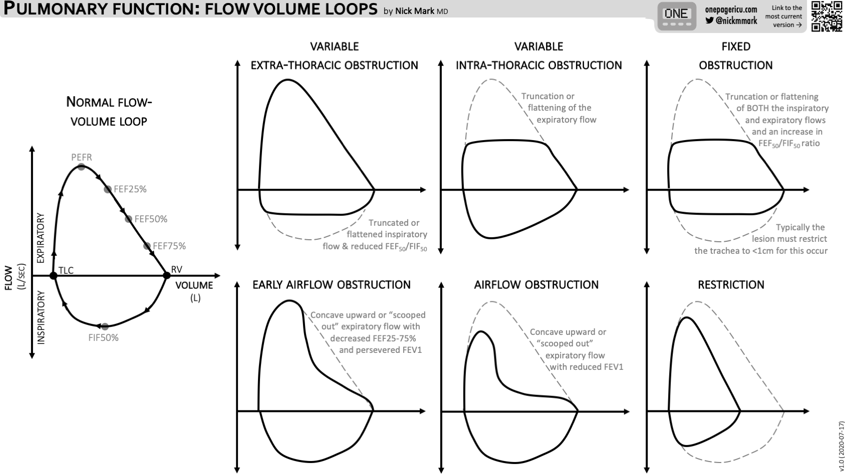 Tracheomalacia Flow Volume Loop