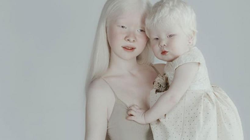 Racisme en discriminatie niet alleen het probleem van witte Nederlanders ad.nl/dossier-protes… 

BEHALVE ALBINO'S BESTAAN ER GEEN WITTE MENSEN VOLGENS DE GROTE VAN DALEN ZO IK VIND NOGAL BELEDIGEND TEGEN HUN