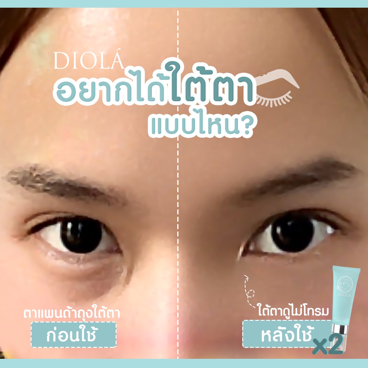 Ttoontester tweet media