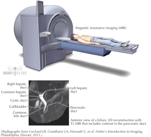 CiruAndes2's tweet photo. Clinical question: what is the contrast used for MRCP imaging? #SoMe4Surgery #MedTwitter @juliomayol @SWexner @salo75 @DrThawabeh @pferrada1 @MISIRG1 @topknife @almagoch #SoMe4ColSurg @OscarGuevaraHPB @ProfW_edinsurg https://t.co/wVwrDEomHg
