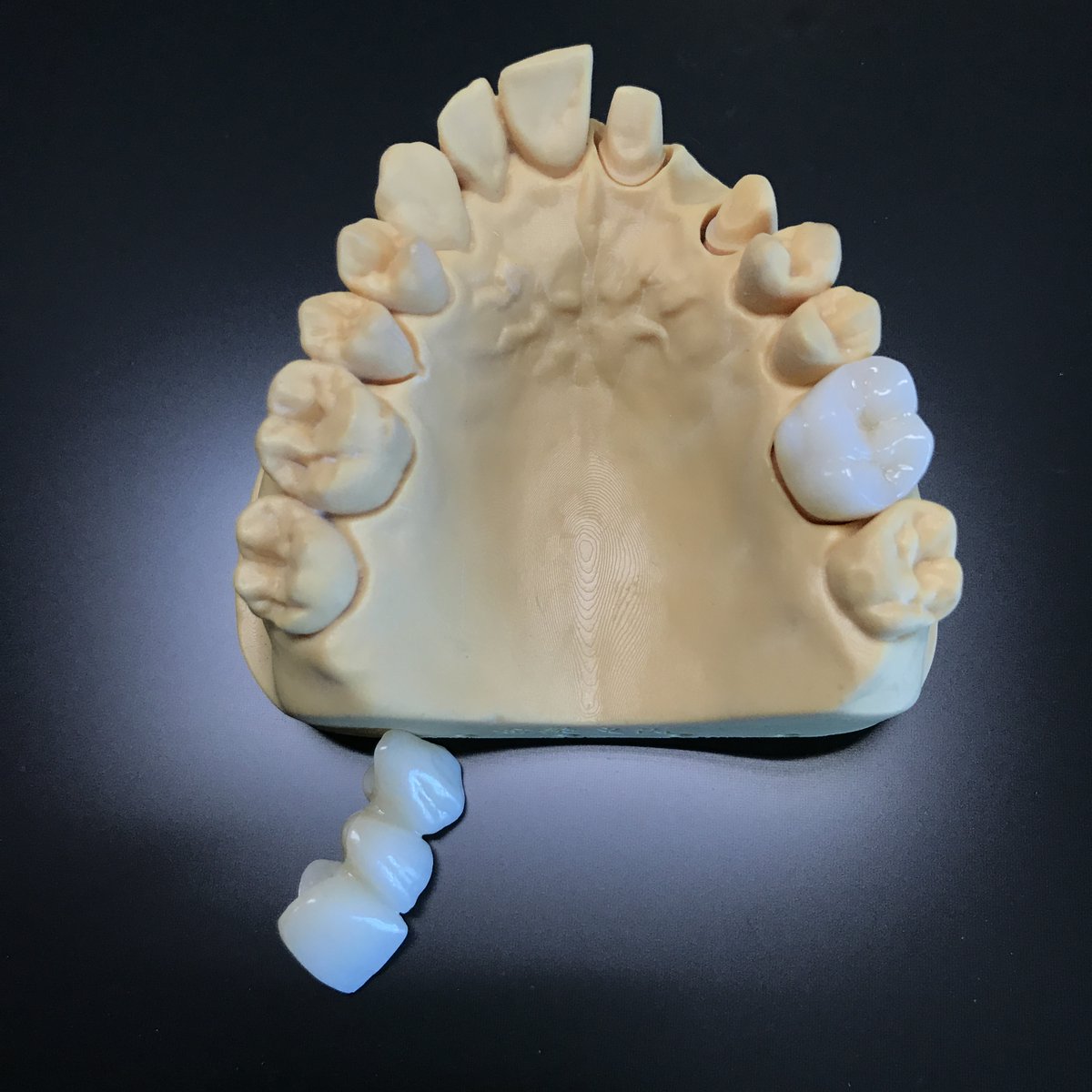 FullService_CDL's tweet photo. Shenzhen Sunflower Dental Lab
 Whatsapp / Wechat : 0086 18823711832
 Email : mr.doczhang@gmail.com
 FDA Establishment Registration: 3012429305
 FDA Assigned Owner/Operator Number: 10051647
 Device Listing: D264421 https://t.co/EXiwyuIWHs
