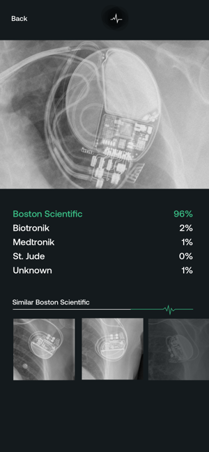 drjohnnyd's tweet image. Has anyone else used @IdPacemaker?  It identifies cardiac devices and manufacturers based on the chest X-ray.  Are there any other #smartphone #Apps physicians need to know about?
#digitalhealth #mhealth #MedTwitter @ACEPNow
