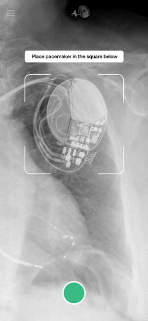 drjohnnyd's tweet image. Has anyone else used @IdPacemaker?  It identifies cardiac devices and manufacturers based on the chest X-ray.  Are there any other #smartphone #Apps physicians need to know about?
#digitalhealth #mhealth #MedTwitter @ACEPNow