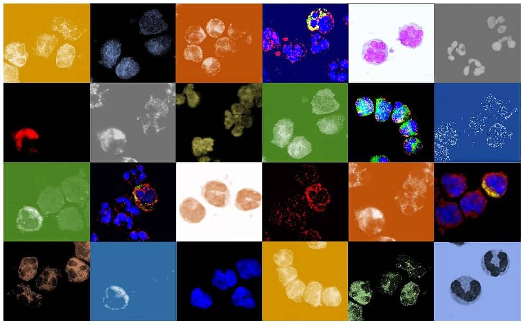 esendaglilab's tweet photo. Kansere karşı mücadelede önemli bir adım daha 👨🏻‍🔬

Another important step on the fight against cancer 🔬
#esendaglilab

#cancer #immunology #cancerimmunology #cancerimmunologyimmunotherapy #biology #cancerbiology https://t.co/xy9VlZWhkq