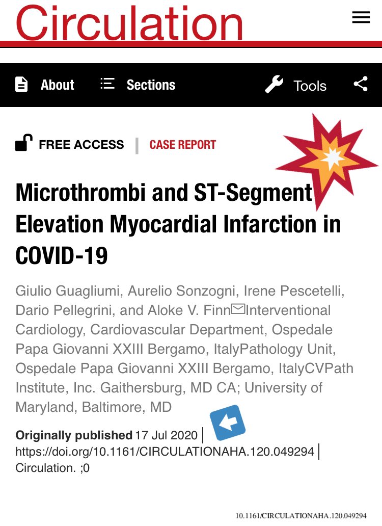 biljana_parapid's tweet photo. @AlokeFinn 🙌🏿🙌🙌🏽🙌🏻🙌🏾🙌🏼 & thanks 4 sharing this 💔 #COVID19 case 📣 need 4 PMs done as they 🎓 us best how we might’ve saved those we failed 2. 😔
#Microthrombus formation & #shock R real & 💊💉 strategies need more vigilance than we get 2 provide due 2 pt overload.
@mirvatalasnag @Hragy https://t.co/Th5HBWQirA