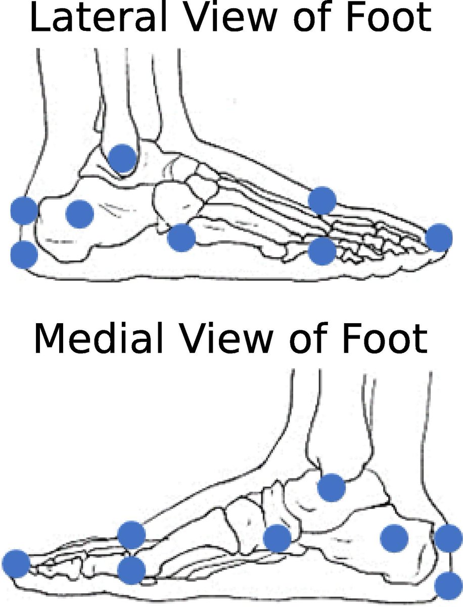 Multi-segment foot model reveals distal joint kinematic differences between habitual heel-toe walking and non-habitual toe walking
sciencedirect.com/science/articl…
#biomechanics