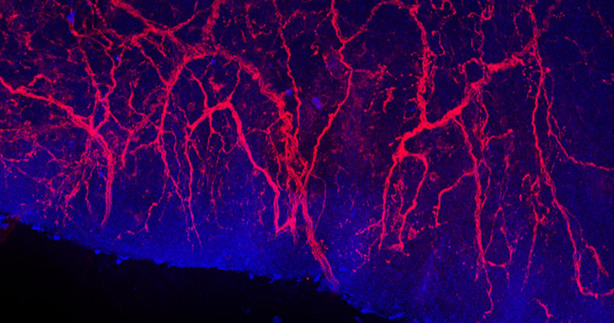 ScienceTM's tweet photo. By studying caregiver reports of children with CDKL5 deficiency disorder, scientists have traced how the CDKL5 protein plays a previously-unrecognized role in pain sensation. @imperialcollege #PainSensitivity https://t.co/9BKmvyoM2K
Credit: J. Clark, B. Harrison, P. La Montanara https://t.co/aeY6t2pxwZ