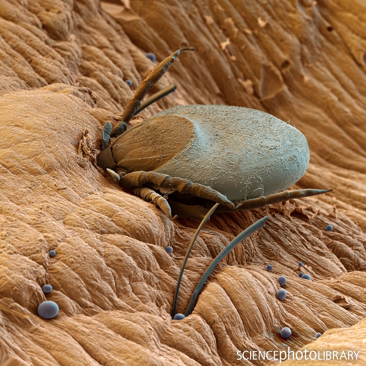 sciencephoto's tweet photo. Did you know that ticks aren't insects? They are classified as arachnids!
SEM of a tick (Ixodes sp. )with its mouthparts buried in the skin of its human host while feeding on its blood.
C: Eye Of Science/SPL
https://t.co/trh0fGGe4P
#arachnid #invertebrates #lymedisease #tick https://t.co/A6OcKns9zj