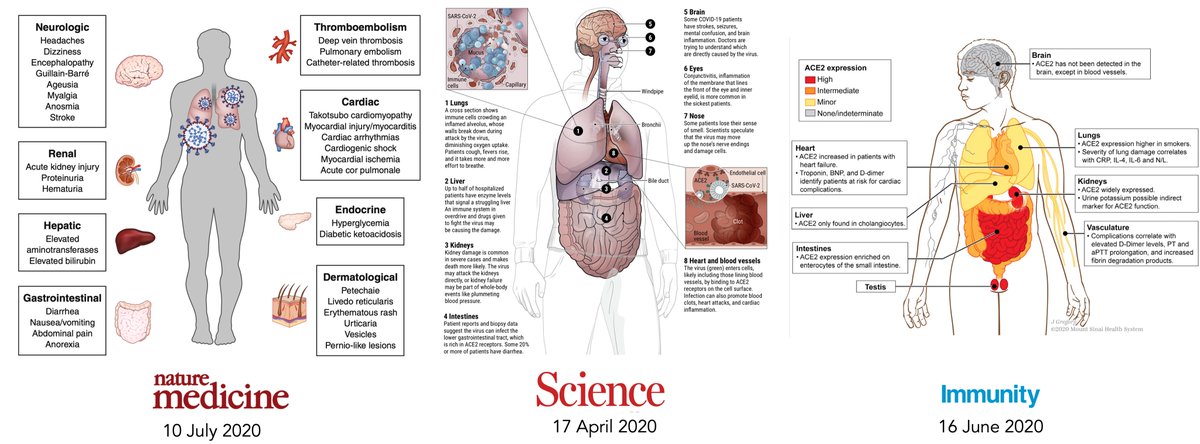 The one thing I was surprised about in the review was lack of mention of the affinity of  #SARSCoV2 to pancreatic islet β cells. This is thought to be another mechanism for new onset  #T1D; there have been many cases reported and an ongoing registry