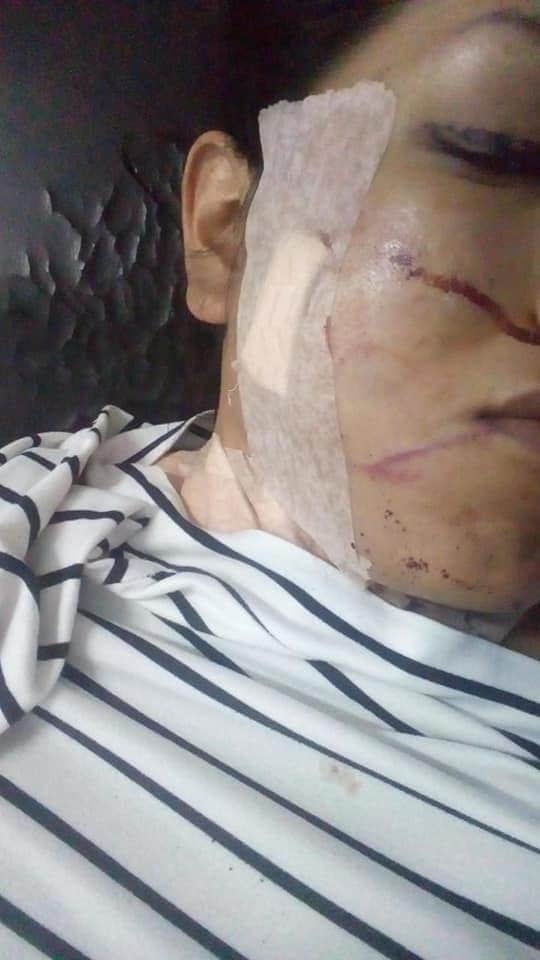 luisito_ayllon's tweet photo. Exigimos justicia para la compañera #CatalinaParada que hoy fue víctima de un intento de transfeminicio, hoy 18 de julio fue apuñalada 8 veces.

#TodasSomosCatalina #BastadeTransfobia #CárcelparalosCrimenesdeOdio

@DPBoliviaOf @NadiaCruzDP @EvaCopa_Bol @SenadoBolivia https://t.co/wM0BV5t9Ev