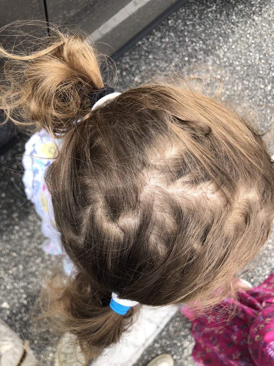 Motherofgirls22's tweet image. Toddler girl mask hack. Make 2 small ponytails and then look mask over them. Avoids falling if too big and doesn’t bother their ears #momhack #maskhack #toddlerlife