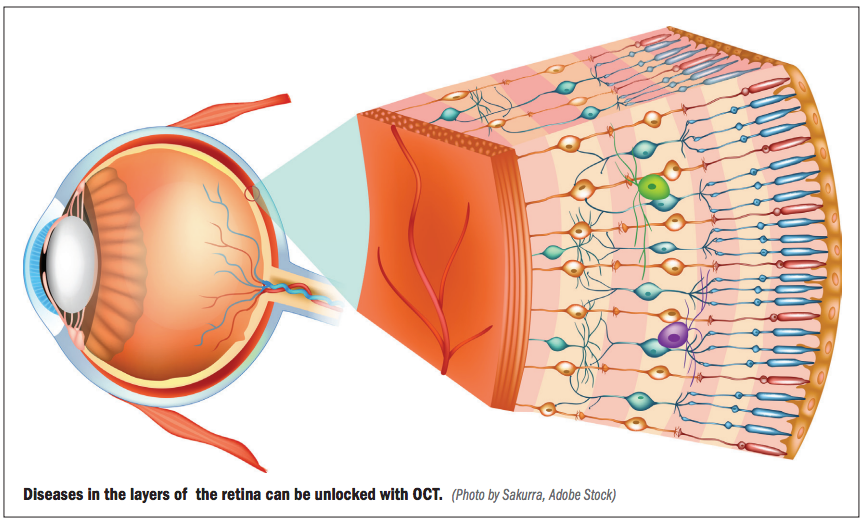 OphthTimes's tweet photo. OCT: Illuminating the retina layer by layer https://t.co/GZgrojWTxr https://t.co/WJ82YroEm0