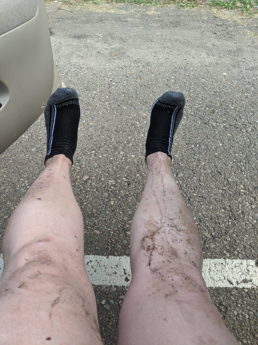 DrZellerSports's tweet photo. Wowzah! First 90 degree MTB ride in COVID times. Super fun! #pgh elevation changes are NO JOKE! Summer legs of a MTB rider! #ladiesallride #trailspgh #CampfireSession #DNKPresents @UPMCSportsMed https://t.co/OxmG7hq14l