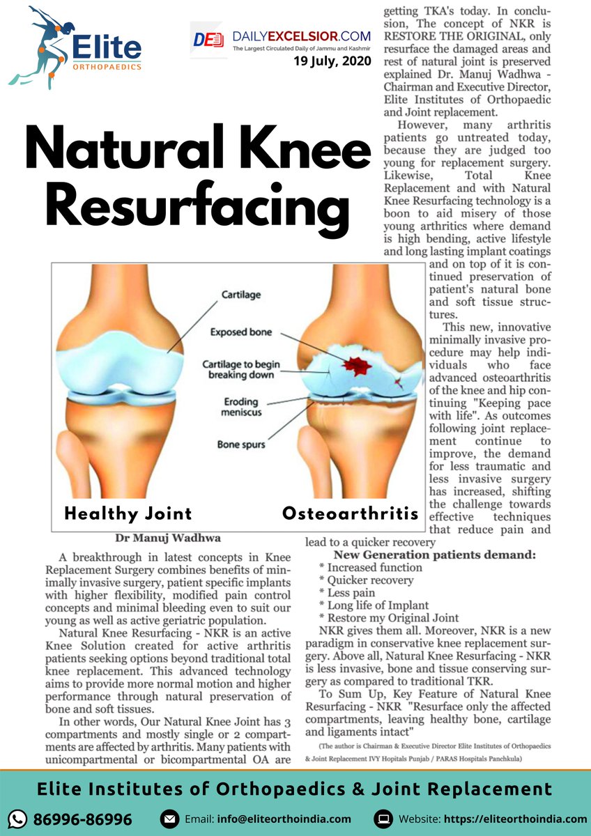 DrManujWadhwa's tweet photo. #MustRead

A breakthrough in latest concepts in Knee Replacement Surgery 
Call 86996-86996 / info@eliteorthoindia.com

#NKR #NaturalKneeResurfacing #TKR #KneeReplacement #BestOrthopaedicsSurgeon #BestKneeReplacement #Mohali #Panchkula #Chandigarh #DrManujWadhwa #EliteOrthopaedics https://t.co/PRXVTVoNZc
