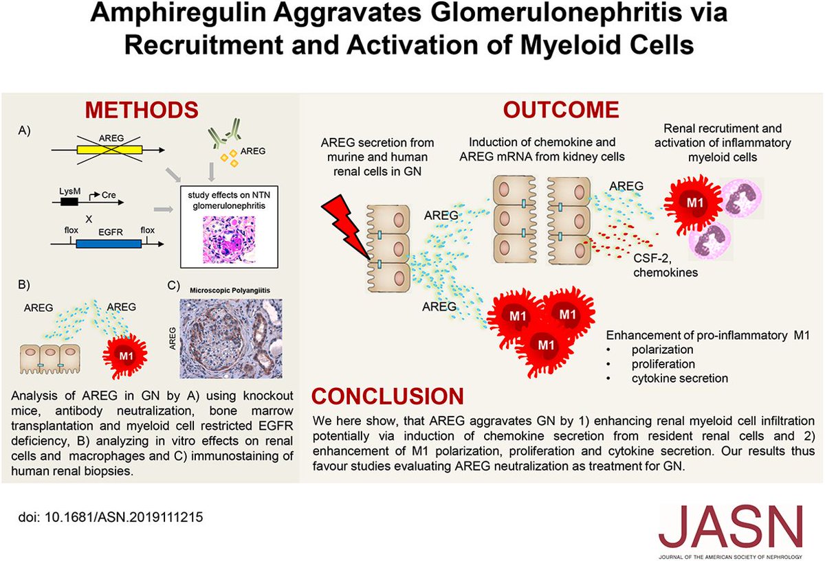 MelderisMD's tweet photo. Happy to have our recent work on #amphiregulin and myeloid cells in #glomerulonephritis published. #nephrology https://t.co/lcJXRCyPwA