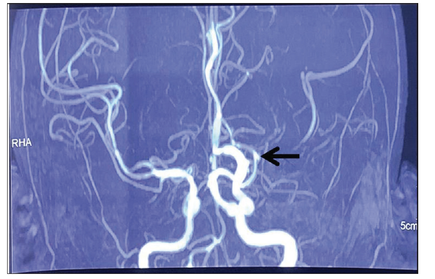 IJRheum's tweet photo. #Extrapulmonary #sarcoidosis presenting as #myositis: A rare case
https://t.co/s7LpB0yxNn
@TheMyositisAssc @MyositisI @MyositisSupport @UKMyositis https://t.co/XXXyTcWCBx