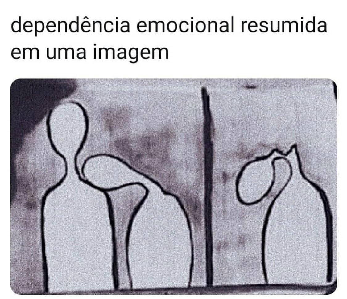 Psiconline2's tweet photo. Dependência não é amor. https://t.co/kycYzCRSBE