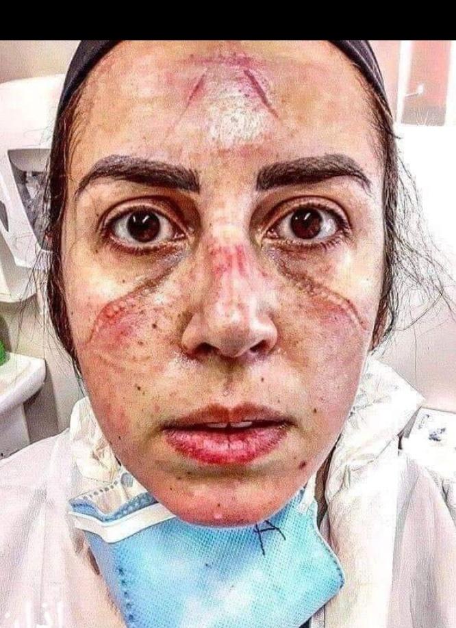Karam89796430's tweet photo. سنڌ جي صحت کاتي جيPPHI ملازمن کي رسڪ الائونس,ٽائيم اسڪيل,هليٿ پروفيشنل الائونس  پڪو ڪري صحت کاتي جي ملازمن جيتري پگھار ڪئي وڃي سنڌ ۾ توهان جي حڪومت آھي وڏو مسئعلو ناهي.
@SindhCMHouse 
@SindhHealthDpt 
@MuradAliShahPPP 
@murtazawahab1 
@BBhuttoZardari https://t.co/XxeBuBph7C