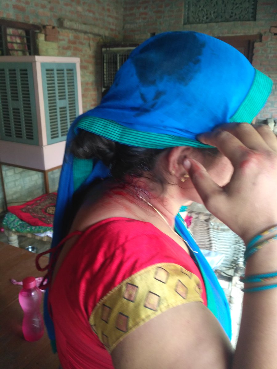 imraazsingh96's tweet photo. महोदय मेरे पडो़सियों द्वारा मेरी मा��� को जमीनी विवाद और गाय बाँधने को लेकर भाले और डण्डे से जानलेवा हमला,सिकरारा थाना द्वारा 323 , 504 धारा लगाकर बात को दबाया जा रहा है कृपया हमारे जान माल की रक्षा करें
@Uppolice @112UttarPradesh @IgRangeVaranasi @dgpup @CMOfficeUP @jaunpurpolice https://t.co/Sx53I6trXH