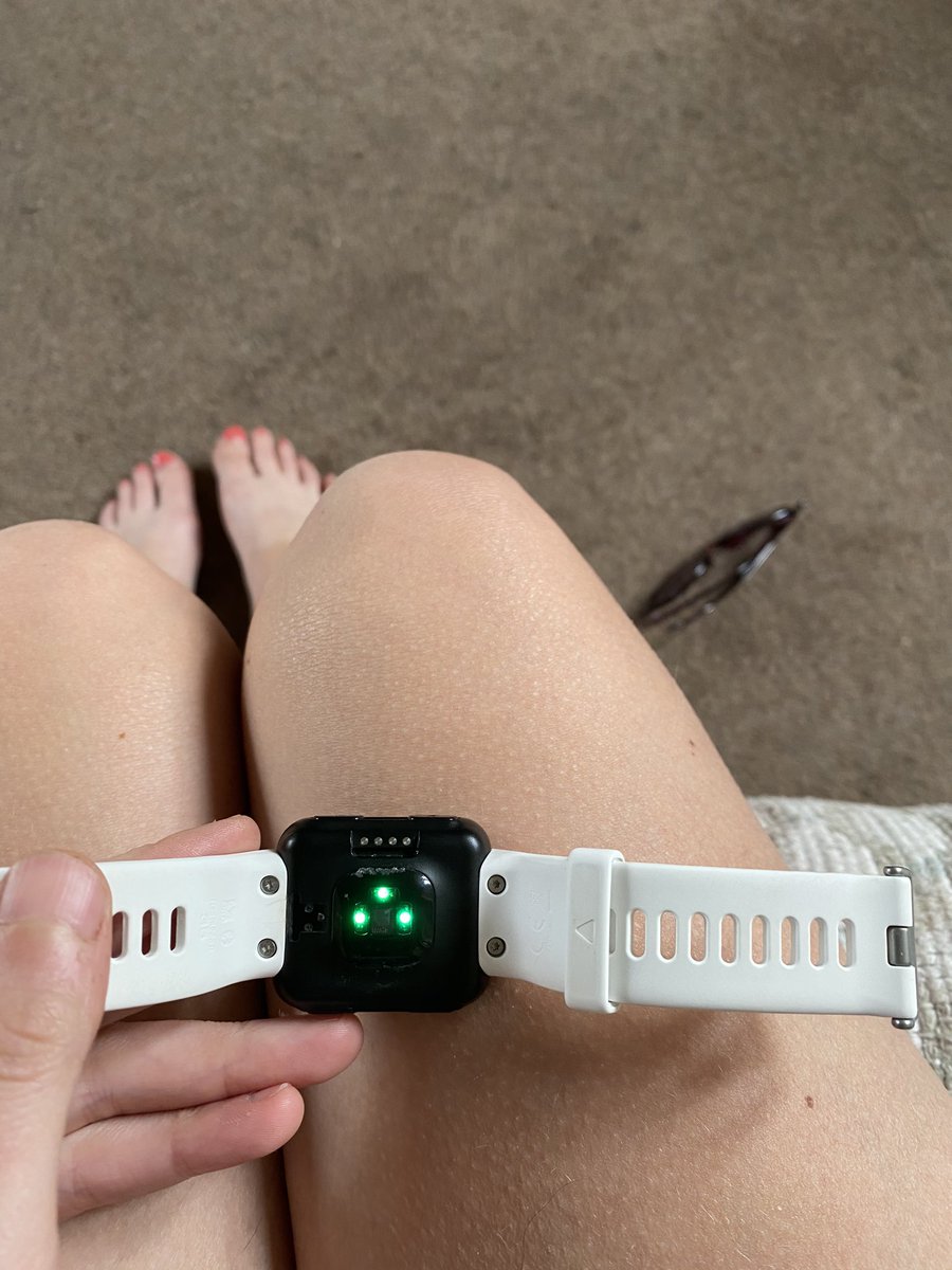 helenturn86's tweet photo. I’ve got a @Garmin forerunner35 and whenever I wear it I end up with what feels like a burn from the loop on the strap!! Anyone noticed anything similar??! #garmin #forerunner35 https://t.co/b8v20GCE2k