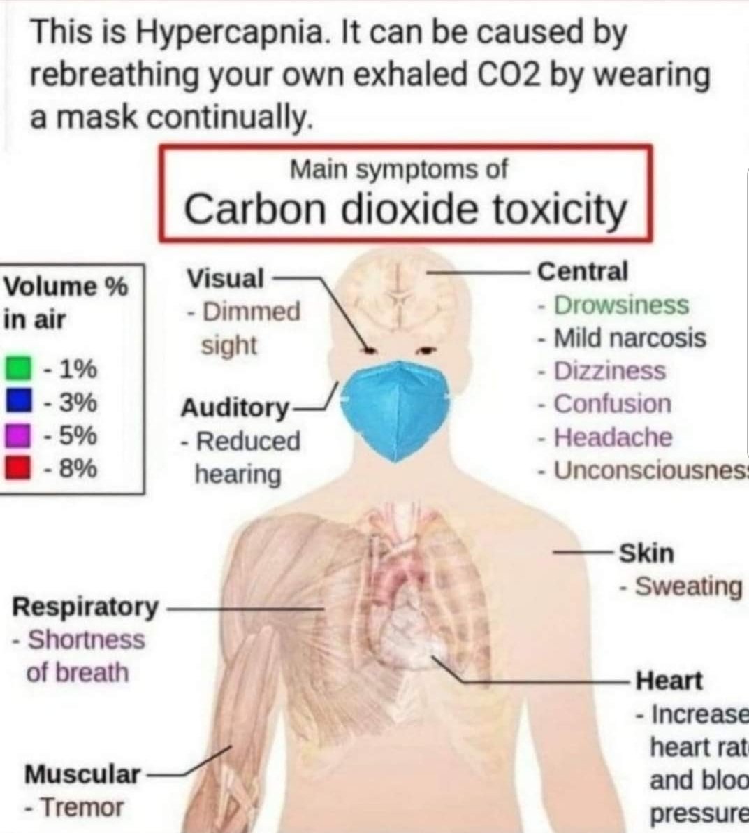 HHC813's tweet photo. @ScottAdamsSays #Mask #masks #Covid19 
#Facemask #Resist #hydroxychloroquinine 
#Plandemic #MAGA #Killernewsome #OMCA #killerMurphey #KillerWhitmer #KillerCuomo #killerwolf https://t.co/00cBetyzl3