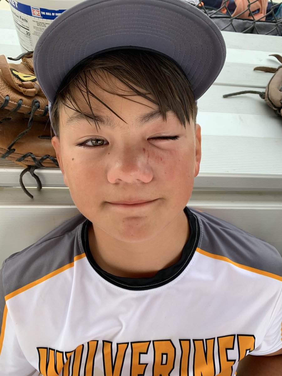 CherylShin4's tweet photo. @HawaiianHitfest #wolverines202011a #HawaiianHitfest Hurt eye, who cares!!  Perseverance that’s what Wolverines do!!! https://t.co/T8s07Ea4Hy