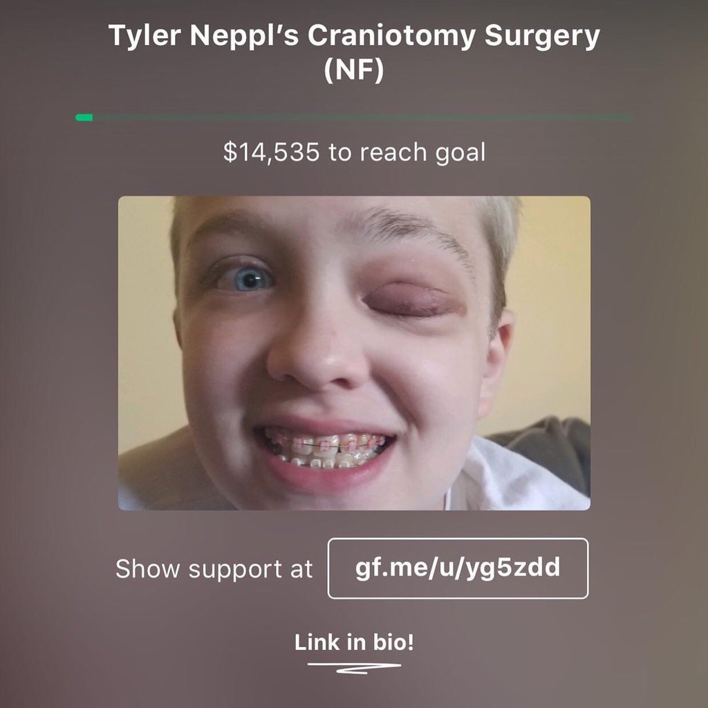 gf.me/u/yg34q3 #TEAMTYLER #ENDNF